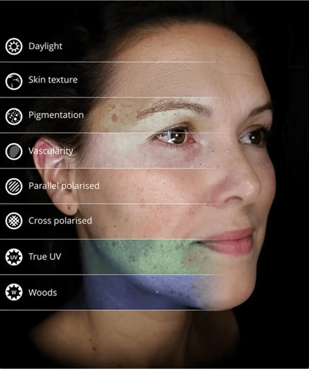 OBSERV skin imaging modes showing pigmentation beneath the surface